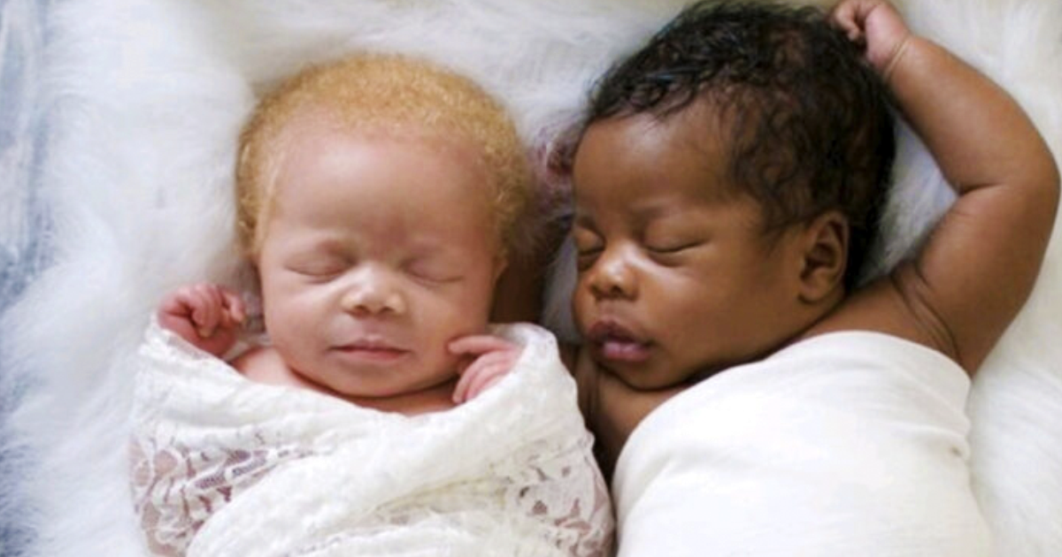 Mujer dio a luz a gemelitos, una es albina y el otro negro. Son preciosos