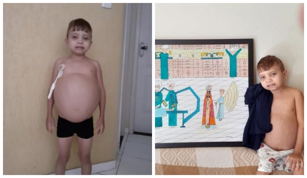 Niño de 13 años sufre una extraña enfermedad y dibuja pinturas de santos para vender y así costear su tratamiento