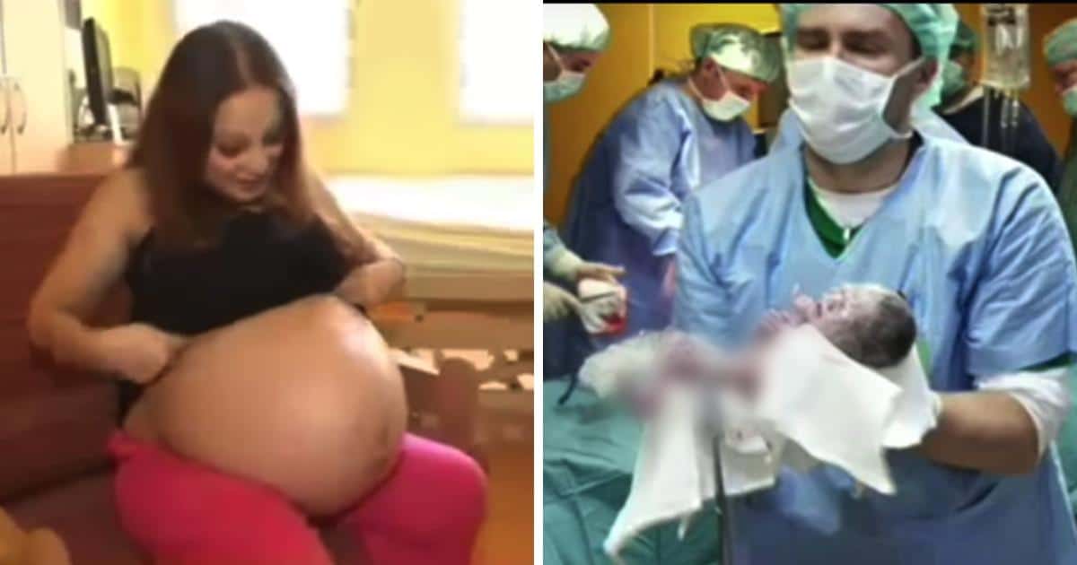 Doctores de la sala de parto se sorprenden al presenciar el raro e histórico parto de una mujer de 23 años