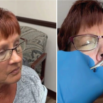 Mujer mayor no podía respirar bien. Lo que le sacaron de la nariz le permitió respirar a la perfección
