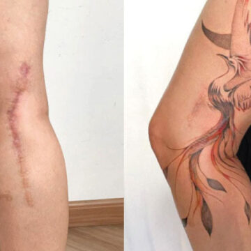 13 cicatrices que se convirtieron en obras de arte a través de tatuajes