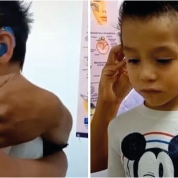 Nació sordo y rompió en llanto tras escuchar por primera vez la voz de su mamá.